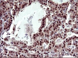 Monoclonal Mouse anti-Human UPRT Antibody (clone OTI1C9, IHC, WB)