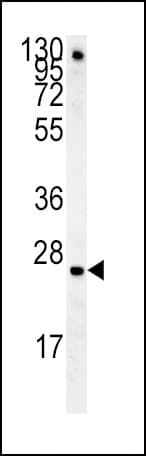 IGFBP4 Antibody (aa96-124)