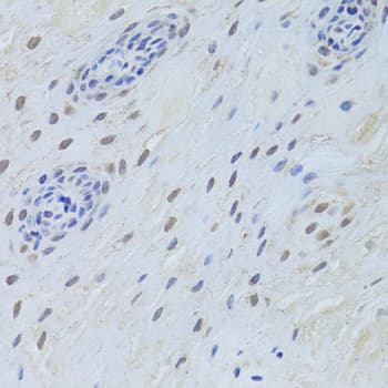 TDP-43 / TARDBP Antibody