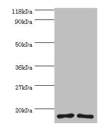 IHC-plus™ Polyclonal Rabbit anti-Human RPS16 / Ribosomal Protein S16 Antibody (IHC, WB)