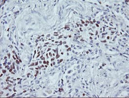 Monoclonal Mouse anti-Human TP53 / p53 Antibody (clone OTI1F4, IHC, WB)