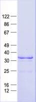 Human HOXB8 Protein (Recombinant His, N-Terminal)