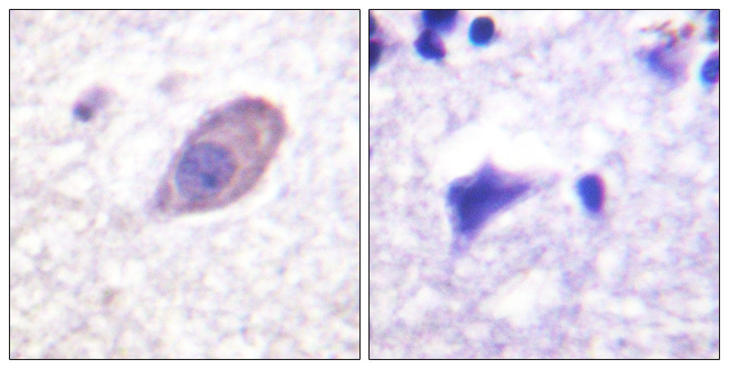 KCNJ16 / Kir5.1 Antibody (p416)