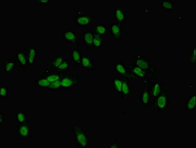 JARID2 / JMJ Antibody