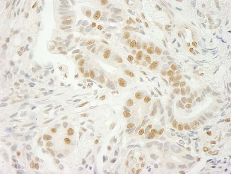 U2AF1 Antibody (aa140-190)