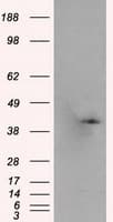 Monoclonal Mouse anti-Human PLEK / Pleckstrin Antibody (clone OTI6B5, IHC, IF, WB)