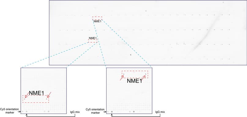 NME1 / NM23 Antibody (clone UMAB91)