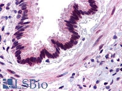 PathPlus™ C3AR / C3a Receptor Antibody (Extracellular Domain)