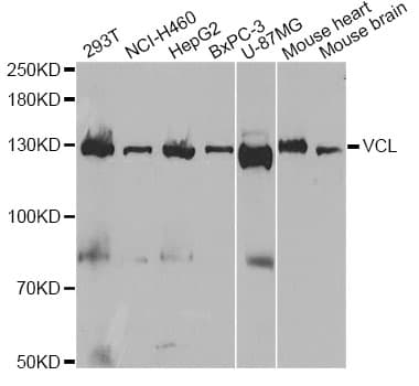 Polyclonal Rabbit anti-Human VCL / Vinculin Antibody (IHC, WB)