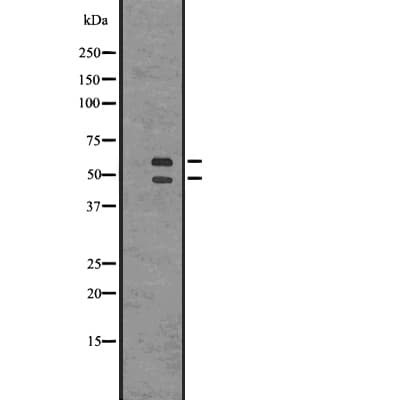 CAMK2B / CaMKII Beta Antibody