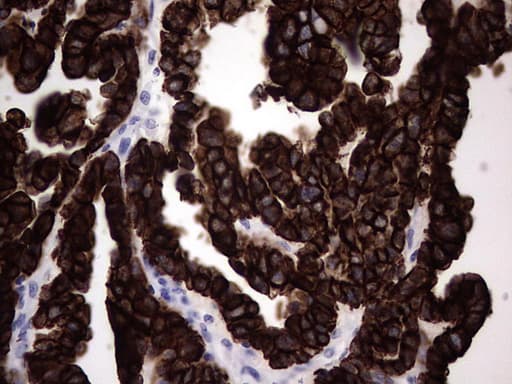 KRT19 / CK19 / Cytokeratin 19 Antibody (aa240-390, clone OTI5G7)