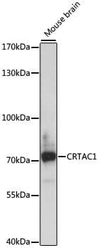 Polyclonal Rabbit anti-Human ASPIC1 / CRTAC1 Antibody (WB)
