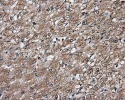 PIM2 / Pim-2 Antibody (clone OTI5D5)