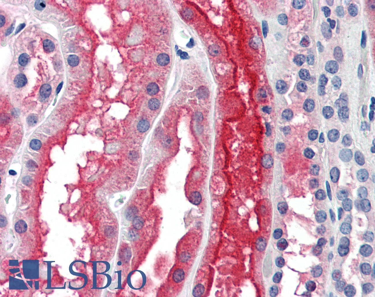 IHC-plus™ Monoclonal Mouse anti-Human PDZK1 Antibody (clone 1C3-2B11, IHC, WB)