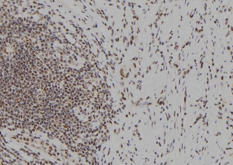 NOL9 Antibody
