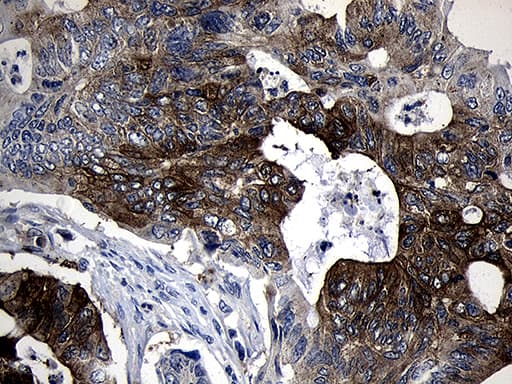 SIRT1 / Sirtuin 1 Antibody (aa552-676, clone OTI5B2)