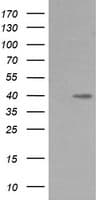 Monoclonal Mouse anti-Human MAP2K3 / MEK3 / MKK3 Antibody (clone OTI5B2, IHC, IF, WB)