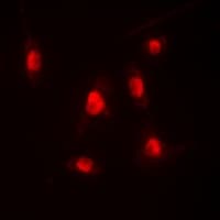 EP300 / p300 Antibody (N-Terminus)