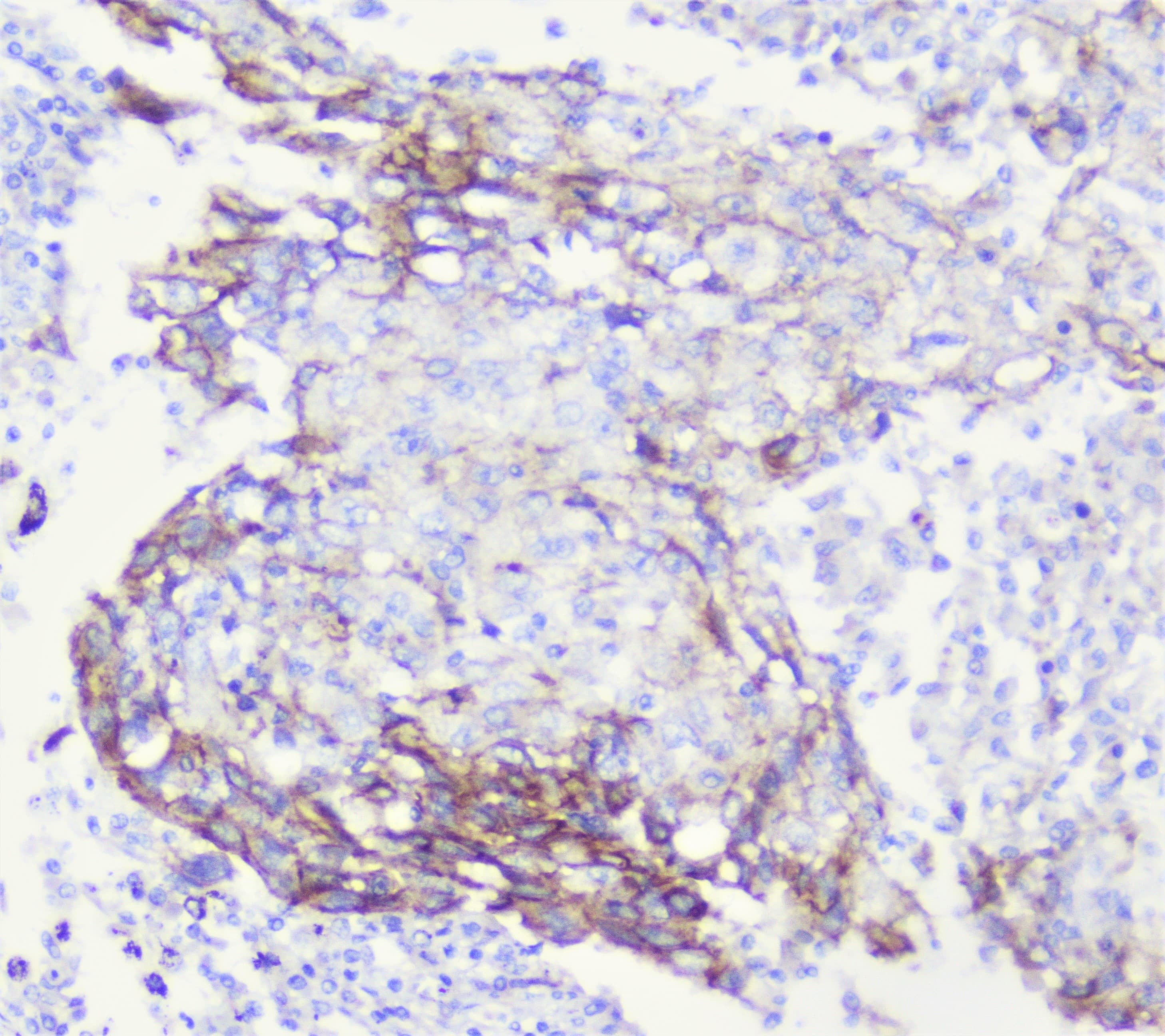 CDH3 / P-Cadherin Antibody