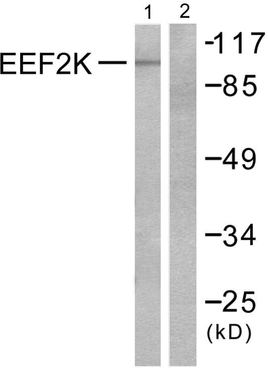 EEF2K Antibody (p366)