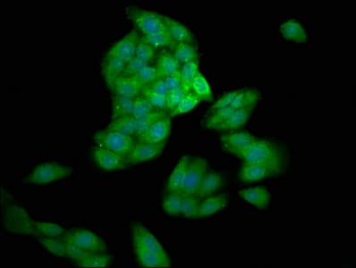 IHC-plus™ CASP10 / Caspase 10 Antibody
