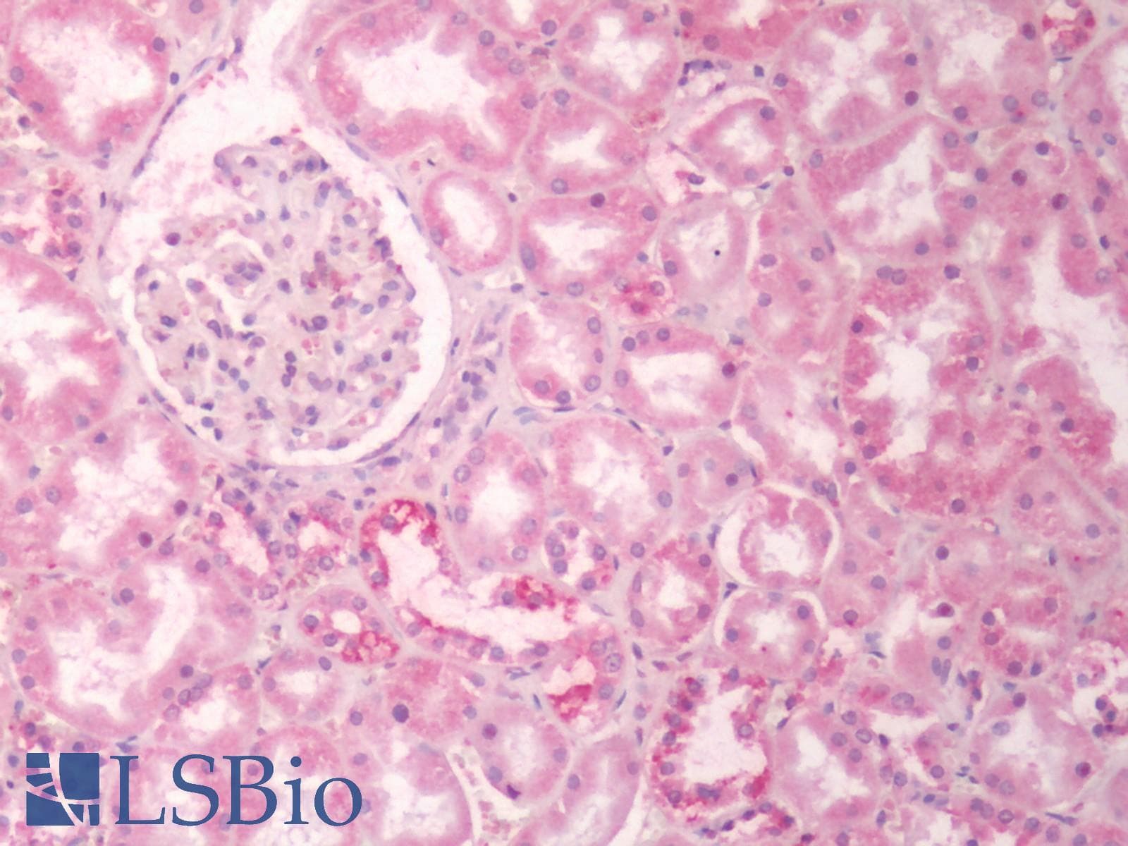 PathPlus™ ADGRD1 / GPR133 Antibody (Cytoplasmic Domain)