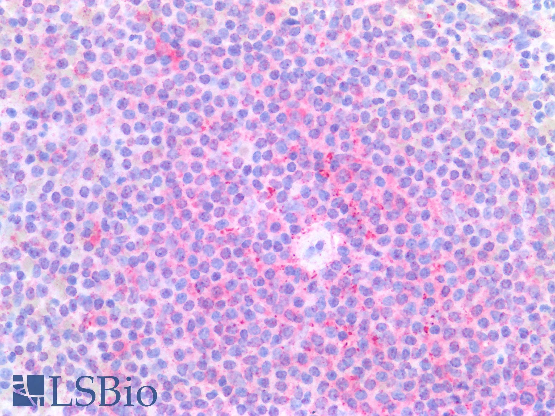 IHC-plus™ XCR1 Antibody (C-Terminus)