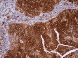 IDH1 / IDH Antibody (clone OTI24A2)