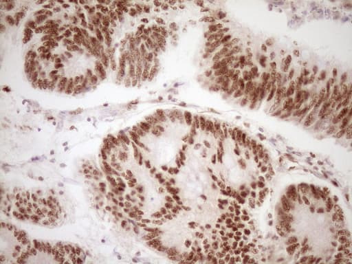LPIN1 / Lipin 1 Antibody (clone OTI8F10)