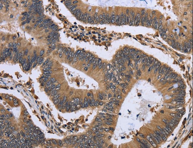 Polyclonal Rabbit anti-Human MYD118 / GADD45B Antibody (IHC)