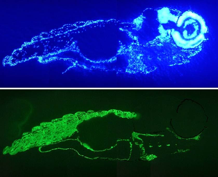 IHC-plus™ Monoclonal Mouse anti-Human Muscle Actin Antibody (clone HHF35, IHC, WB)