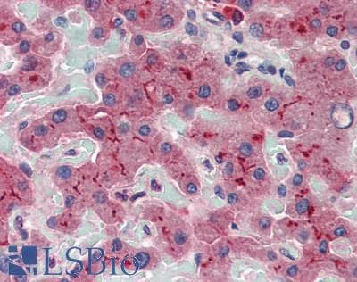ABCB11 / BSEP Antibody (aa421-663)