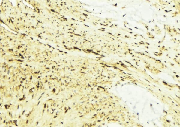 Polyclonal Rabbit anti-Human FAAH Antibody (IHC, WB)