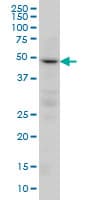 PPP2R2C Antibody (clone 6D1)
