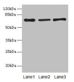 Alpha-Fetoprotein Antibody