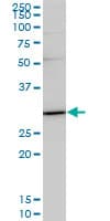 Monoclonal Mouse anti-Human TRADD Antibody (clone 3G1, WB)