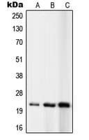 RPL10 / Ribosomal Protein L10 Antibody (N-Terminus)
