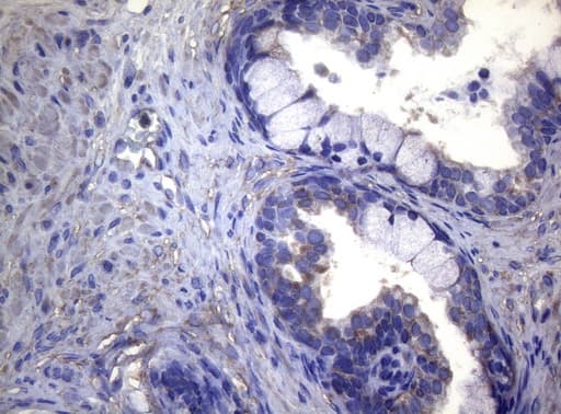 MAK Antibody (aa291-623, clone OTI5A7)