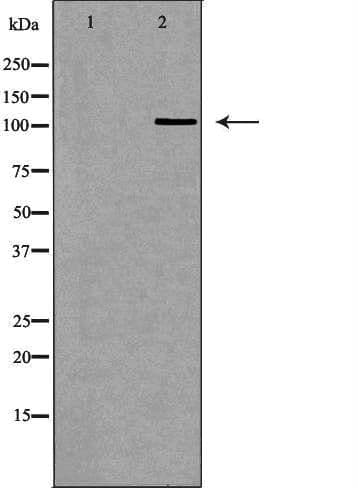Polyclonal Rabbit anti-Human RB1 / Retinoblastoma / RB Antibody (IHC, IF, WB)