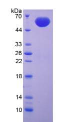 Human FBN2 / Fibrillin 2 Protein (Recombinant His-GST)
