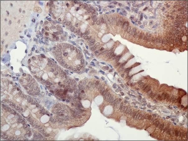 PYCARD / ASC / TMS1 Antibody