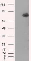 ACSBG1 / hsBG Antibody (clone OTI2B5)
