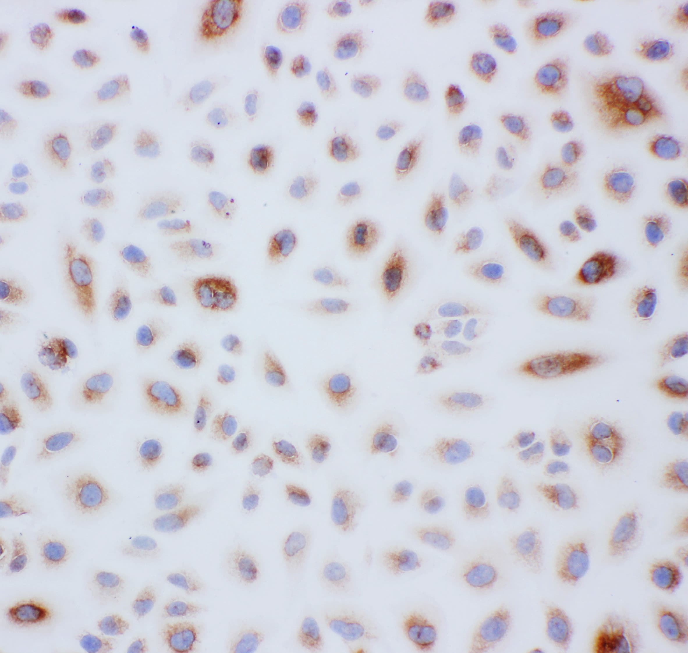 Polyclonal Rabbit anti-Human PRDX3 / Peroxiredoxin 3 Antibody (aa239-256, IHC, WB)