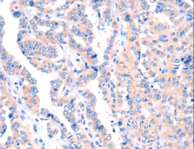 Polyclonal Rabbit anti-Human APBA2 Antibody (IHC)