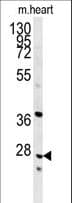 Polyclonal Rabbit anti-Human INMT Antibody (aa101-128, IHC, WB)
