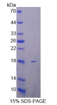 Bovine Collagen X Protein (Recombinant His-T7)