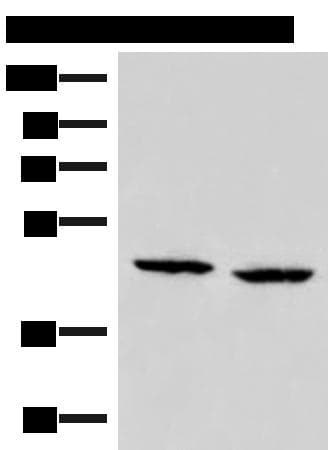ZFYVE27 / Protrudin Antibody