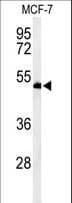 TIP49 / RUVBL1 Antibody