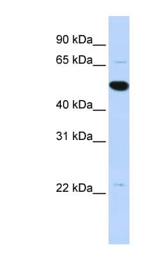 ARHGAP36 / FLJ30058 Antibody (aa468-517)