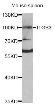 ITGB3 / Integrin Beta 3 / CD61 Antibody